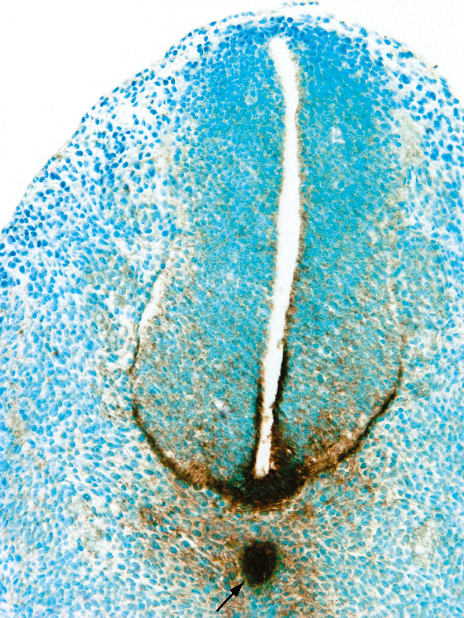 Fig. 4.8, Cross Section Showing Sonic Hedgehog (Shh) Protein (Dark Brown) in the 11- to 111/2-Day Postcoitum Mouse