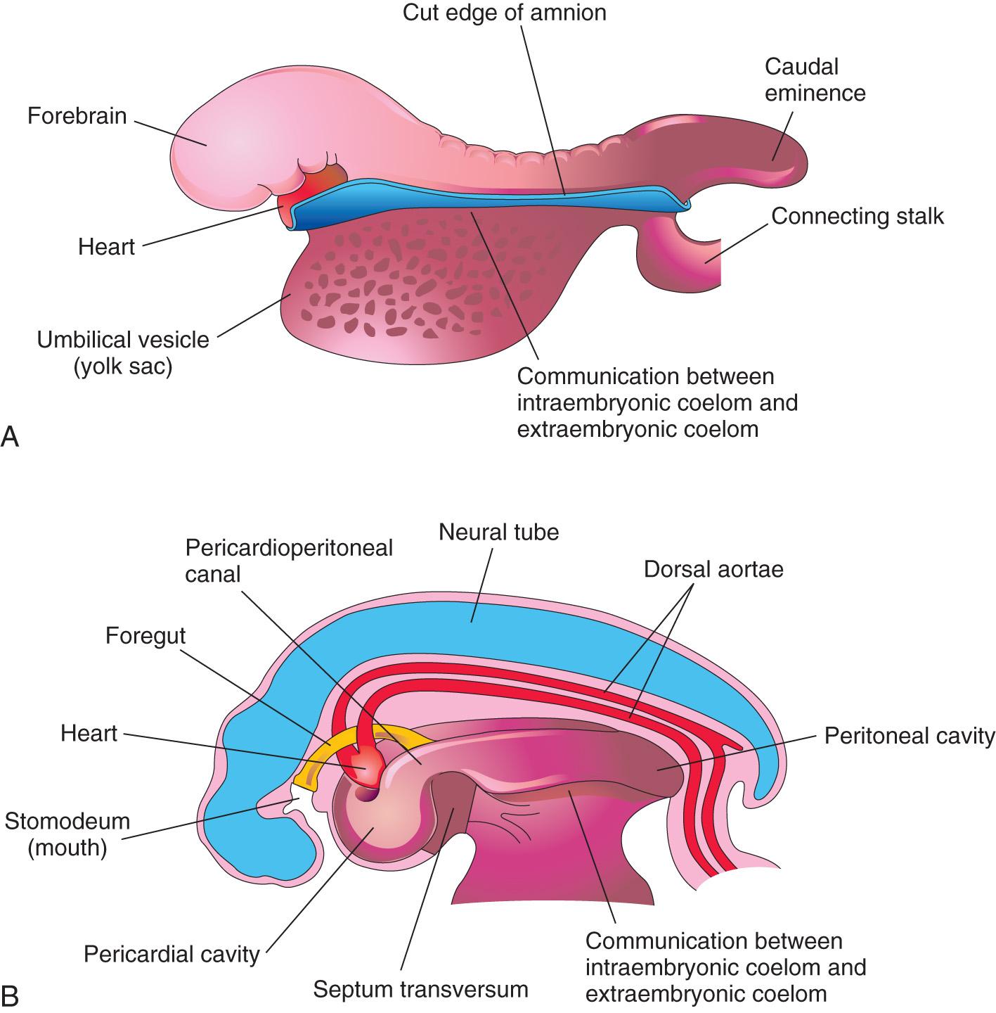 Fig. 5.3, Drawings of the effect of the head fold on the intraembryonic coelom. A , Lateral view of an embryo (24 to 25 days) during folding, showing the large forebrain, ventral position of the heart, and communication between the intraembryonic and extraembryonic parts of the coelom. B , Schematic drawing of an embryo (26 to 27 days) after folding, showing the pericardial cavity ventrally, the pericardioperitoneal canals running dorsally on each side of the foregut, and the intraembryonic coelom in communication with the extraembryonic coelom.