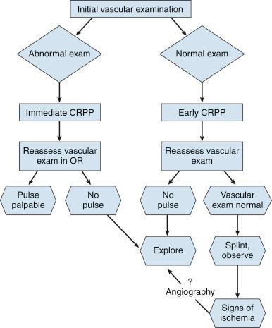 Fig. 17.24, Flowchart to guide decision-making in cases in which a possible vascular injury is associated with a displaced supracondylar humeral fracture. CRPP, Closed reduction and percutaneous pinning; OR, operating room.