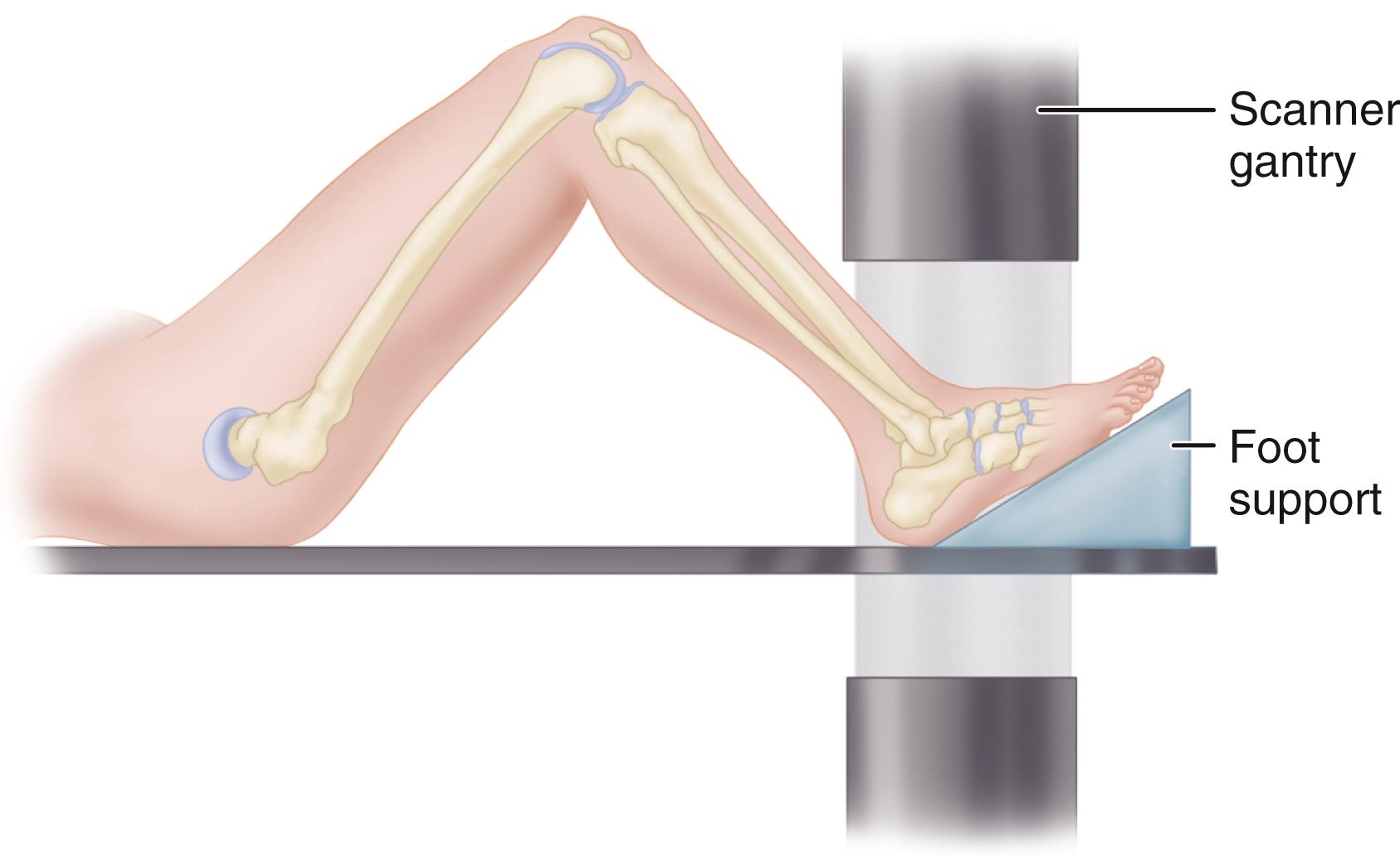 FIGURE 89.6, Patient positioning for coronal CT of hindfoot.