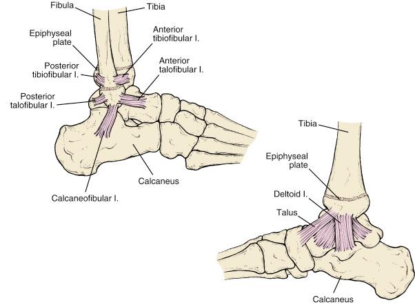 Fig. 15.2, The ligaments of the foot. Medial and lateral views of the ankle showing the ligamentous anatomy. Note the relationship of the physes to the ligaments.