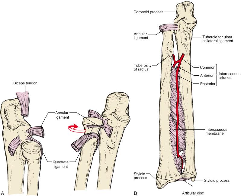 Fig. 18.6, (A) The annular ligament is the major stabilizing structure of the proximal radioulnar articulation. When the forearm is supinated, the anterior border of the quadrate ligament becomes taut and draws the radial head snugly against the radial notch of the ulna. (B) The interosseous membrane.