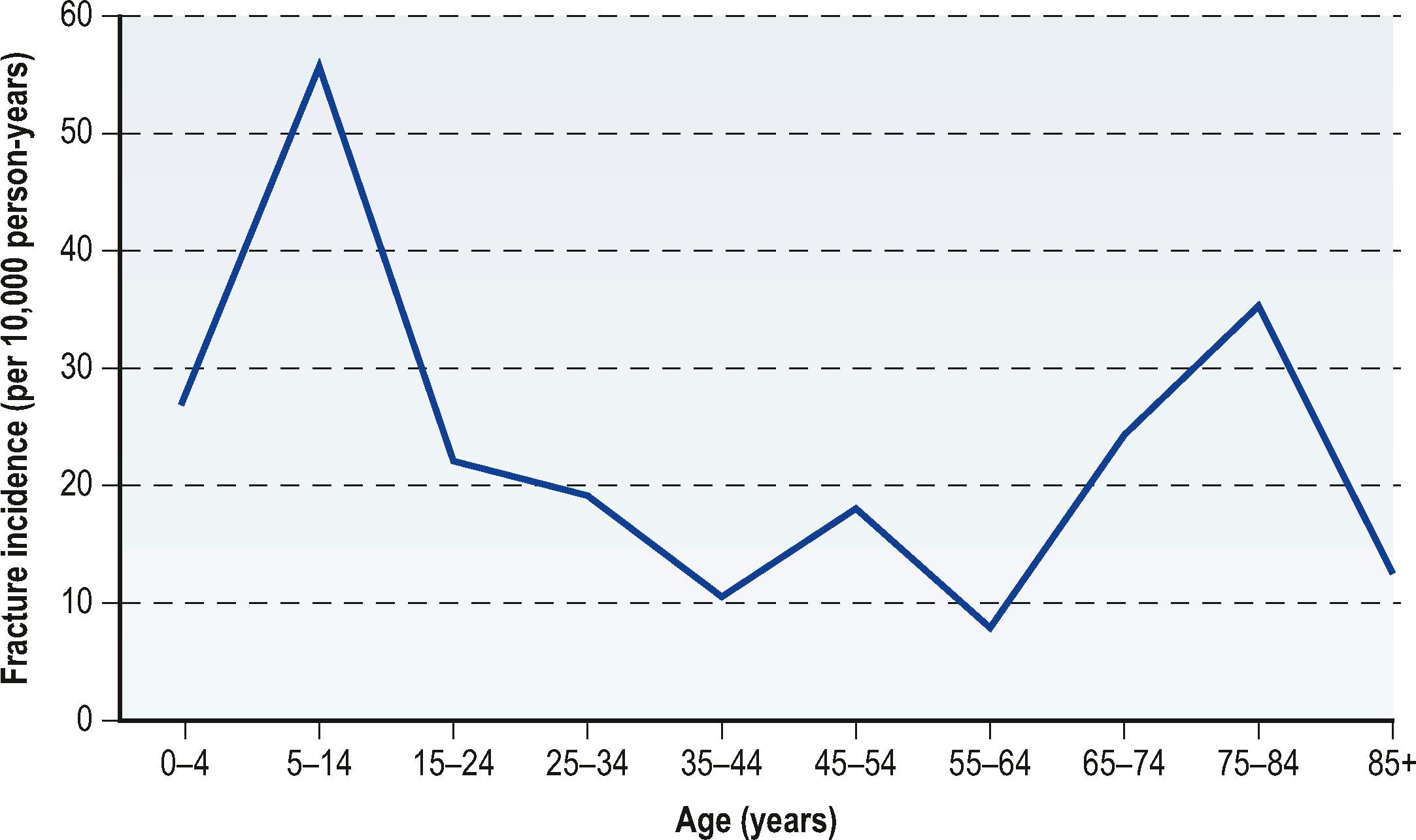 Figure 8.1, Age-related variation in radius/ulna fracture incidence.