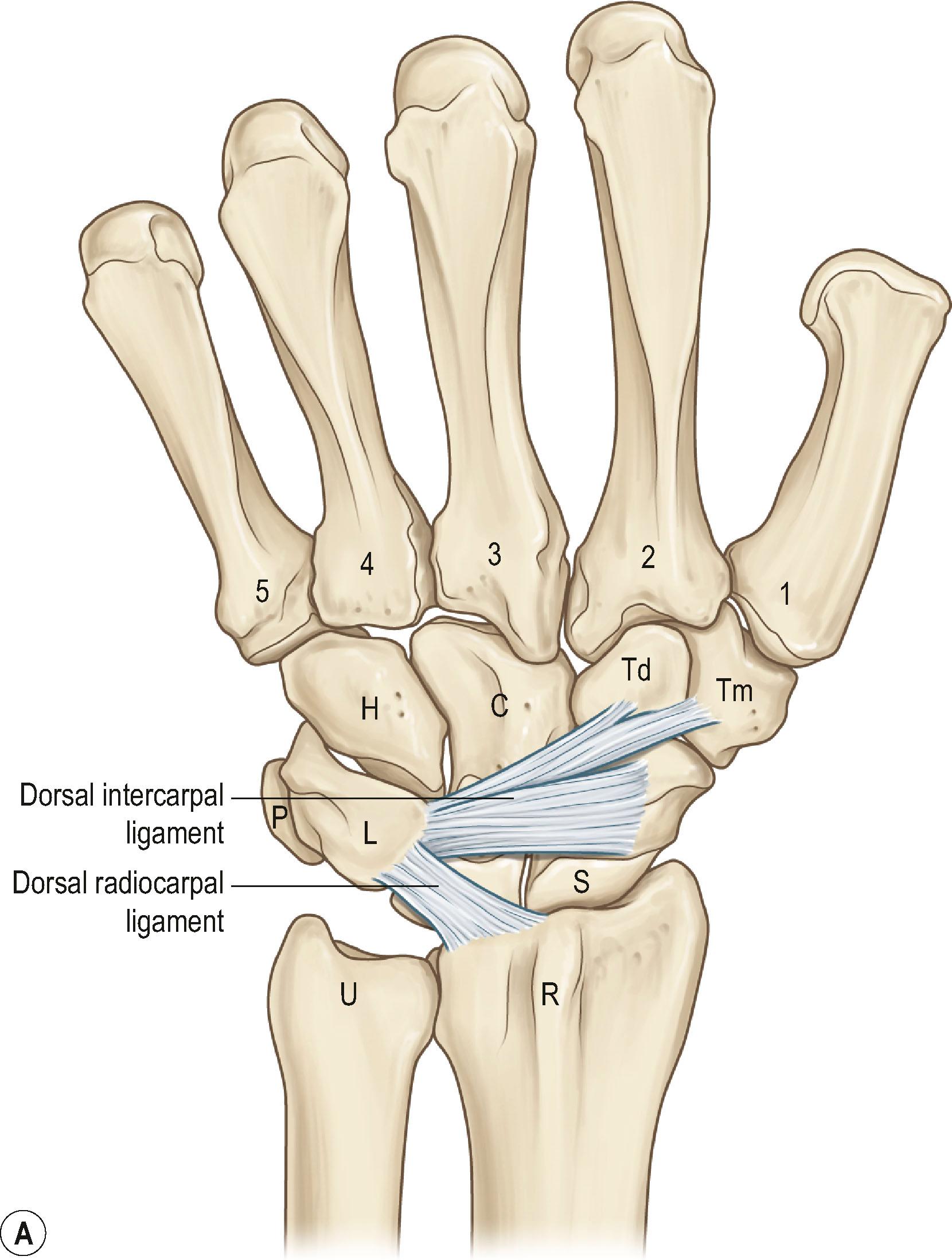 Figure 8.5, (A) Dorsal extrinsic wrist ligaments. (B) Volar extrinsic wrist ligaments. (C) Intrinsic wrist ligaments. C, Capitate; H, hamate; L, lunate; P, pisiform; R, radius; S, scaphoid; Td, trapezoid; Tm, trapezium; U, ulna.