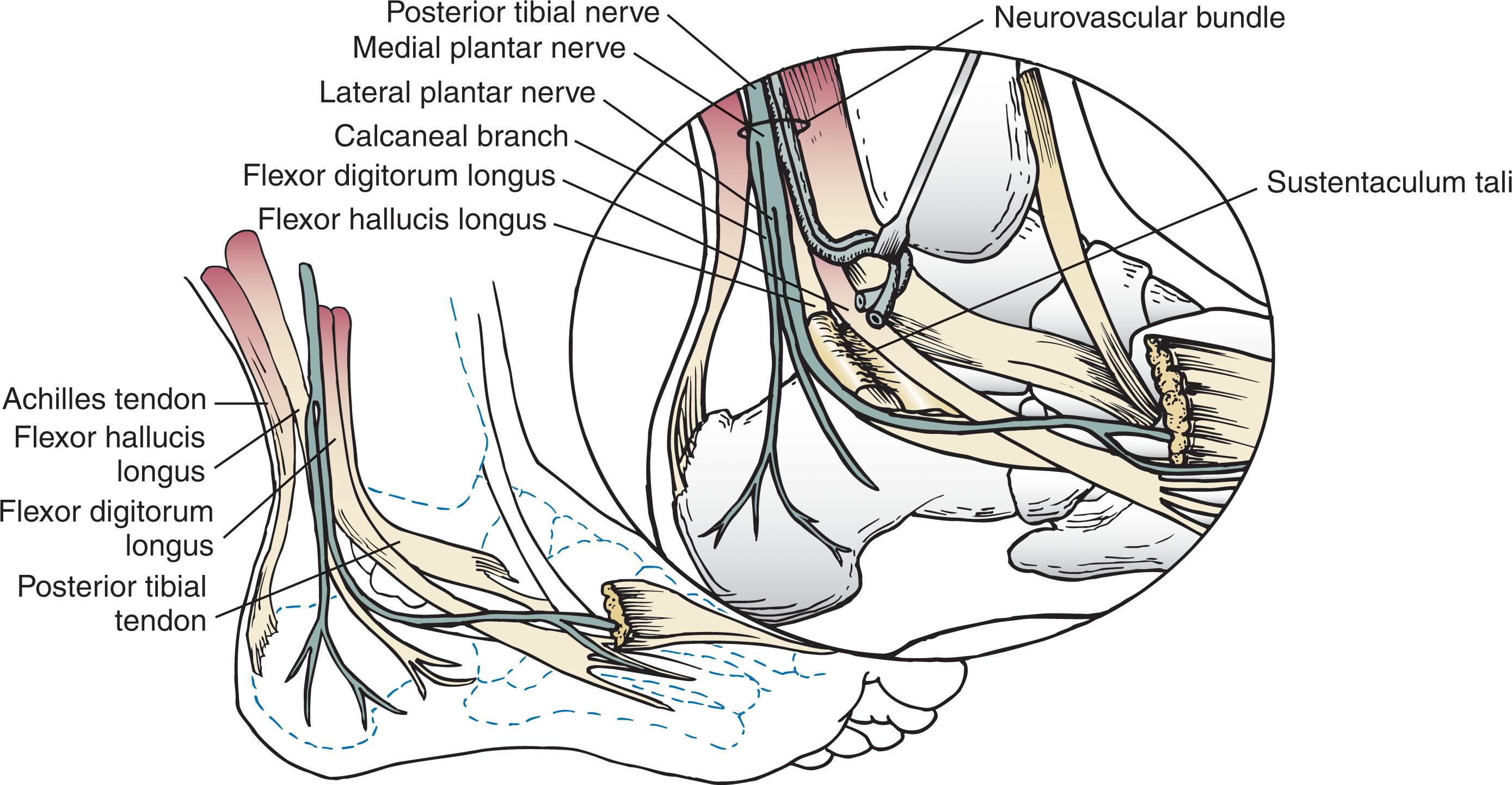 Fig. 45-3, Medial soft tissue structures that surround the calcaneus.