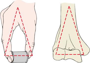 Fig. 45.2, The trochlea functions as the articulating axis of the distal end of the humerus. It is held between two bony columns, much like the ends of a spool of thread held between the thumb and index finger.