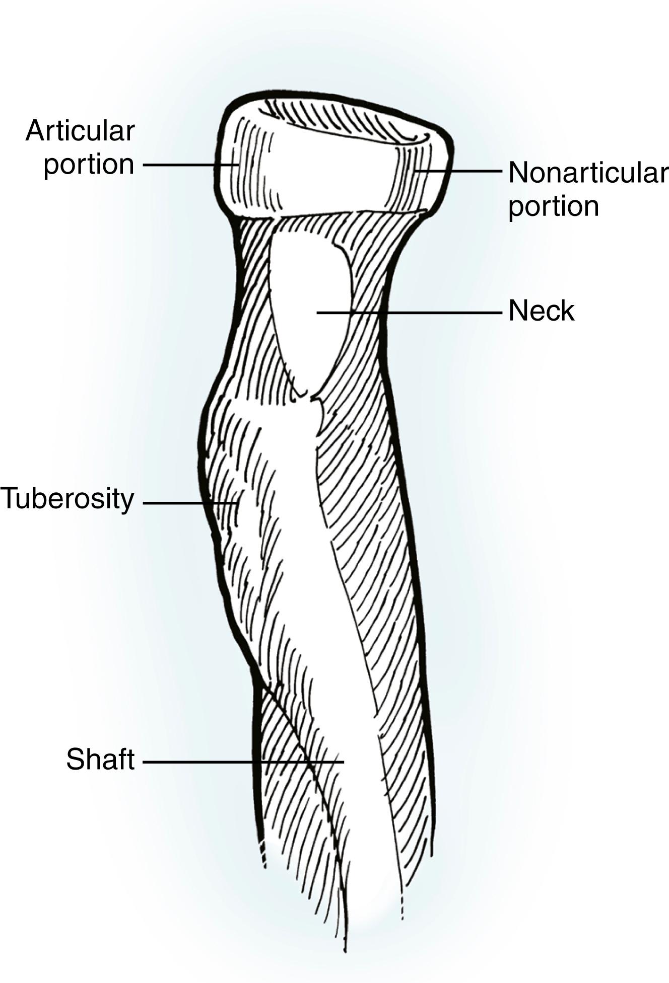 Fig. 19.7, Anatomy of the proximal radius. The radial head is somewhat elliptical. The concave surface of the radial head that articulates with the capitellum is variably offset in a radial direction from the axis of the radial neck. The portion of the radial head that does not articulate with the radial notch of the ulna is more rounded, whereas the articulating portion is more flattened.