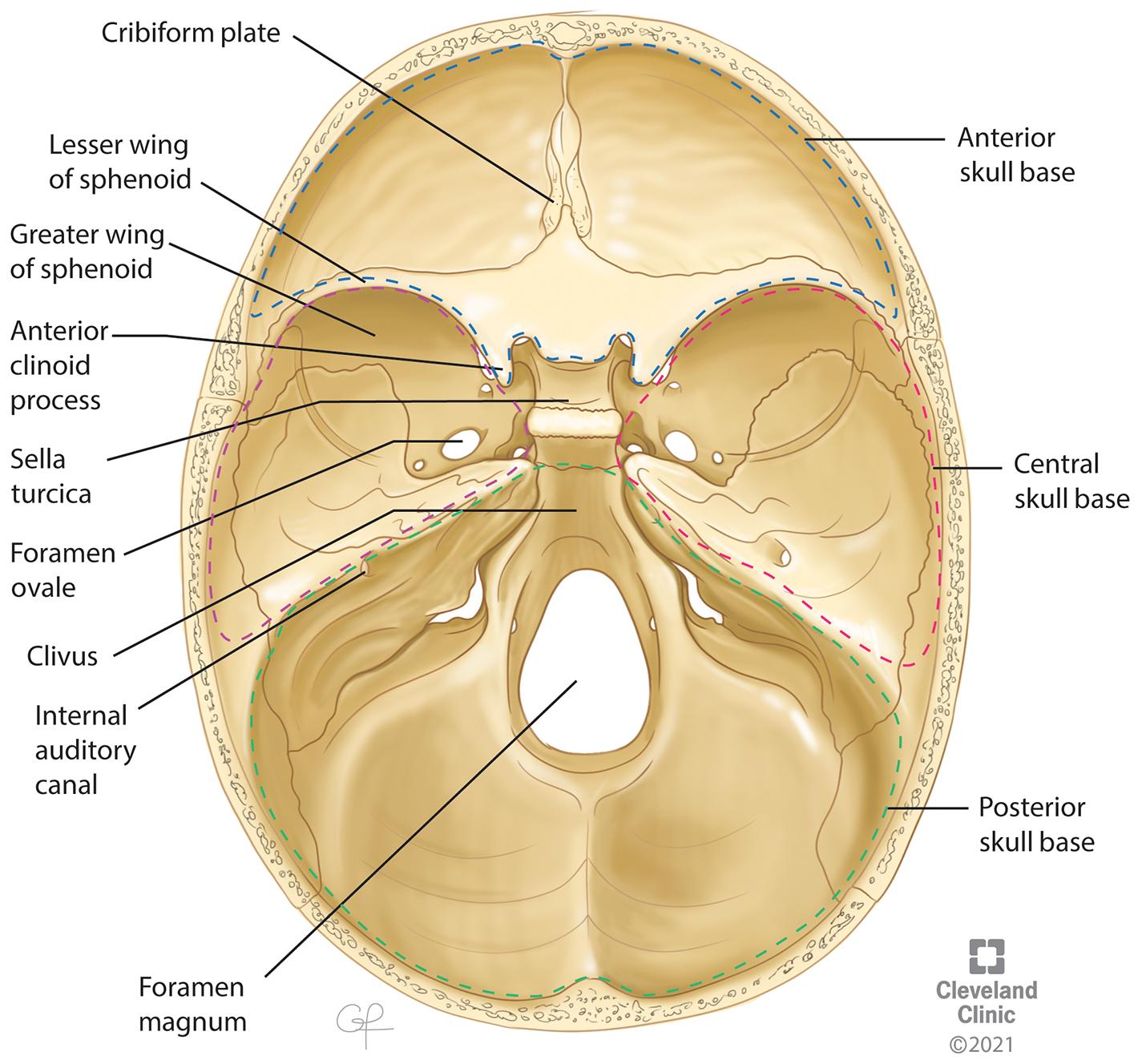 Fig. 37.2, Image depicting the commonly described three anatomical regions of the skull base along with its boundaries and anatomical associations.