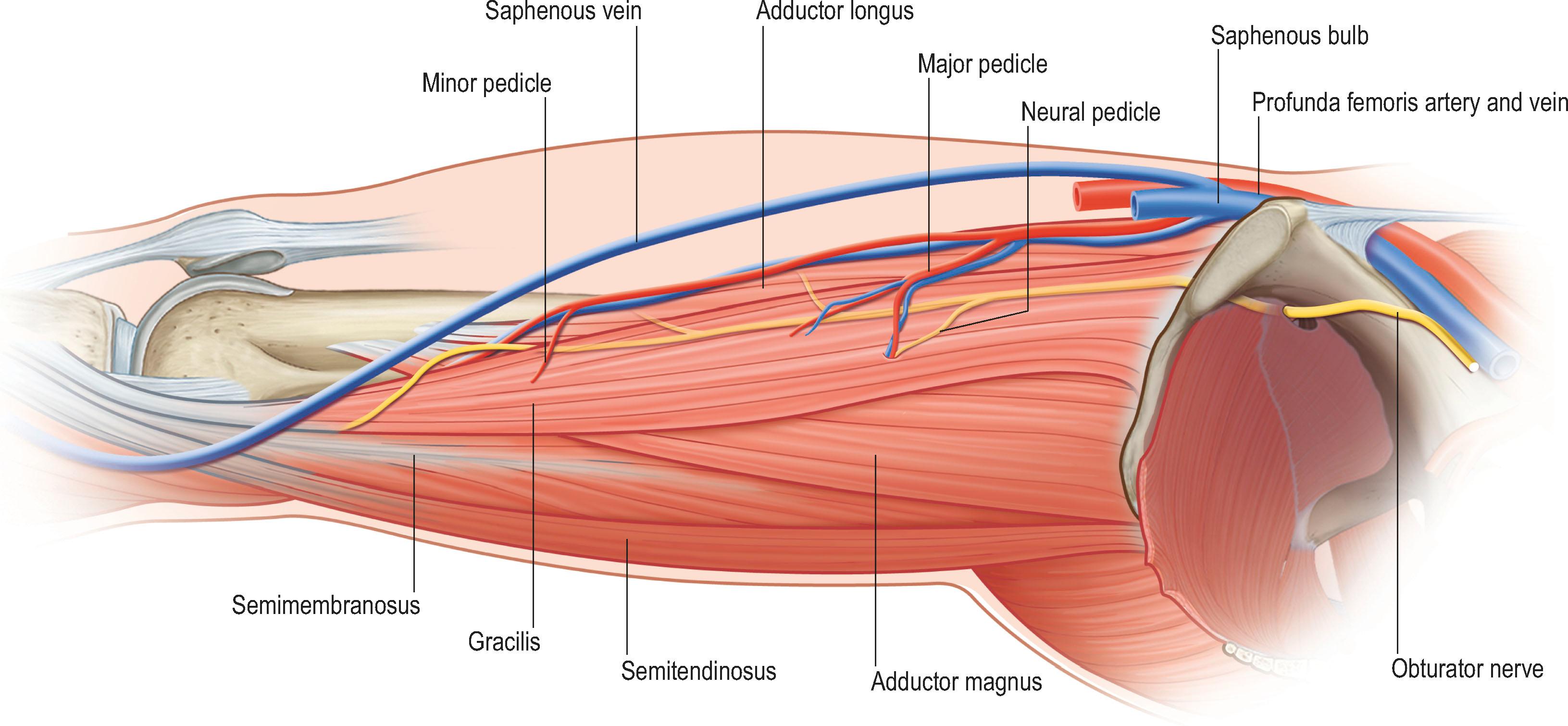 Figure 27.1, Anatomy of the gracilis muscle, including vascular and neural pedicles.