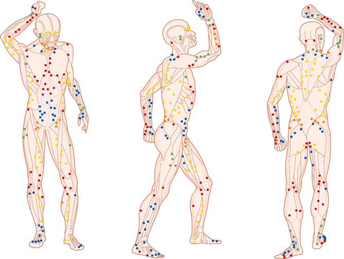 Figure 62.1, The dominant cutaneous perforators emerging from the deep fascia, with different colors identifying their corresponding source arteries in the deep layers. Note their relationship to the intermuscular and the intramuscular septa.