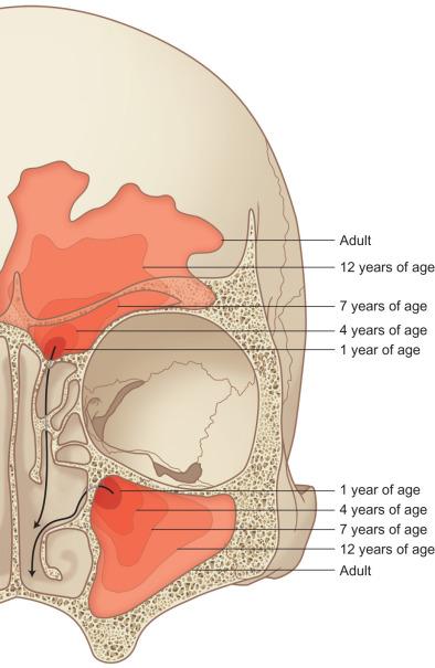 Fig. 1.7.1, Frontal sinus development.