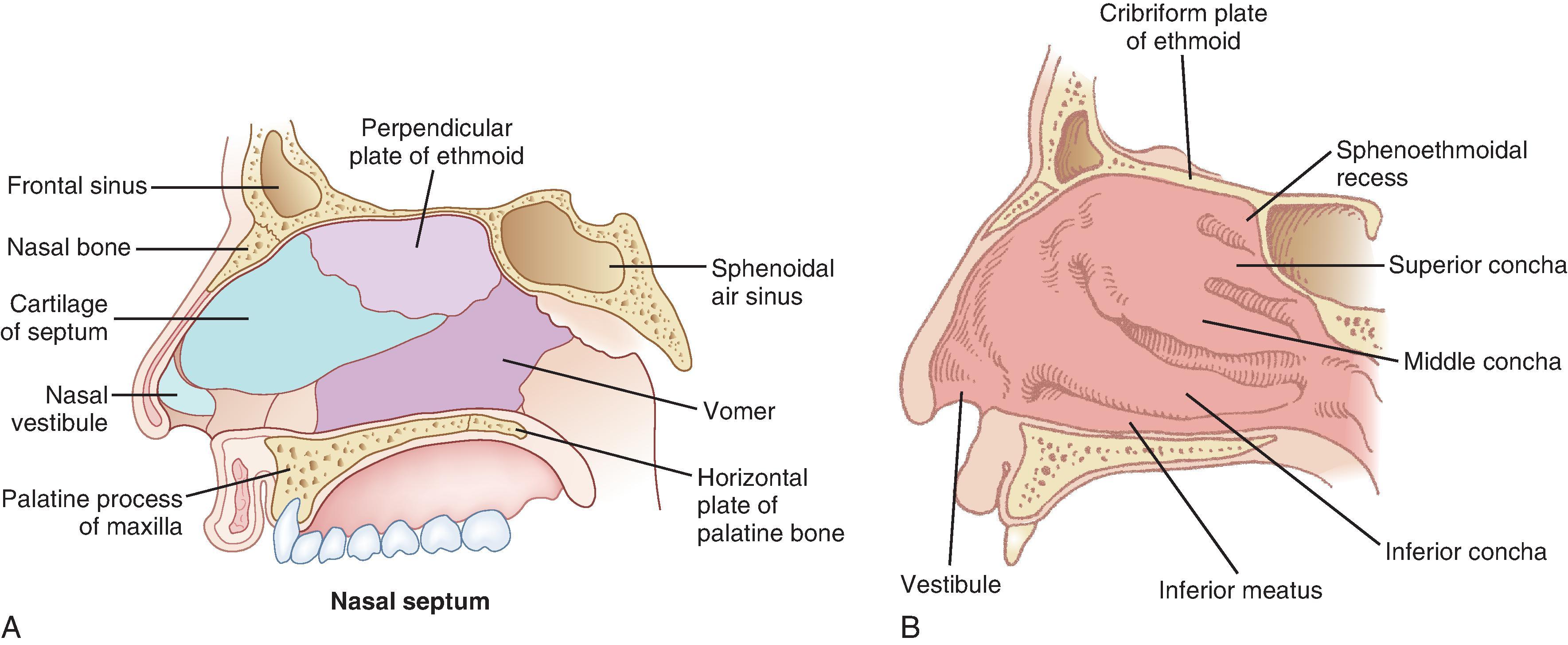 Fig. 1.1, (A) Medial wall (septum) of the nasal cavity. The sphenoid sinus opens into the sphenoethmoidal recess. The frontal, maxillary, and ethmoidal sinuses open into meatuses of the nose. Notice that the nasal septum contains cartilage in front and bone in the back. (B) Lateral wall of the nasal cavity. The conchae are also known as the nasal turbinates .