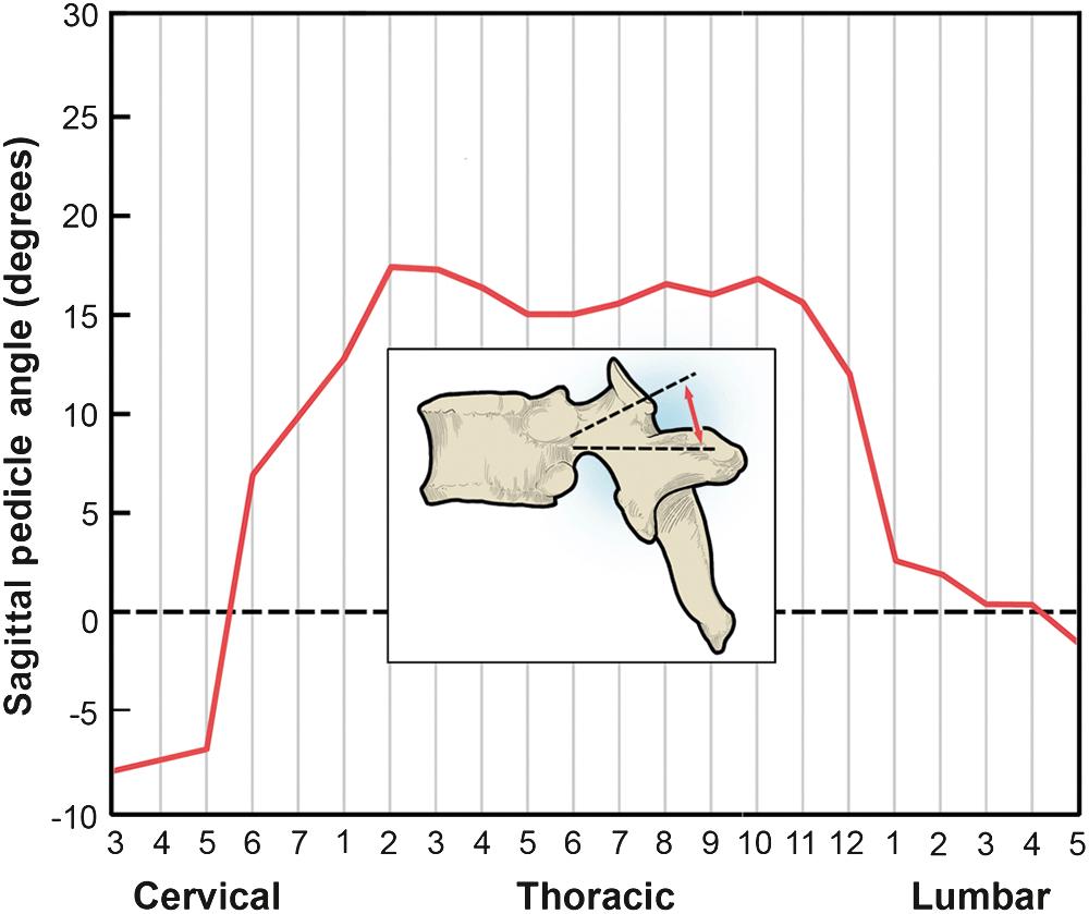 Fig. 4.6, Sagittal pedicle angle versus spinal level.