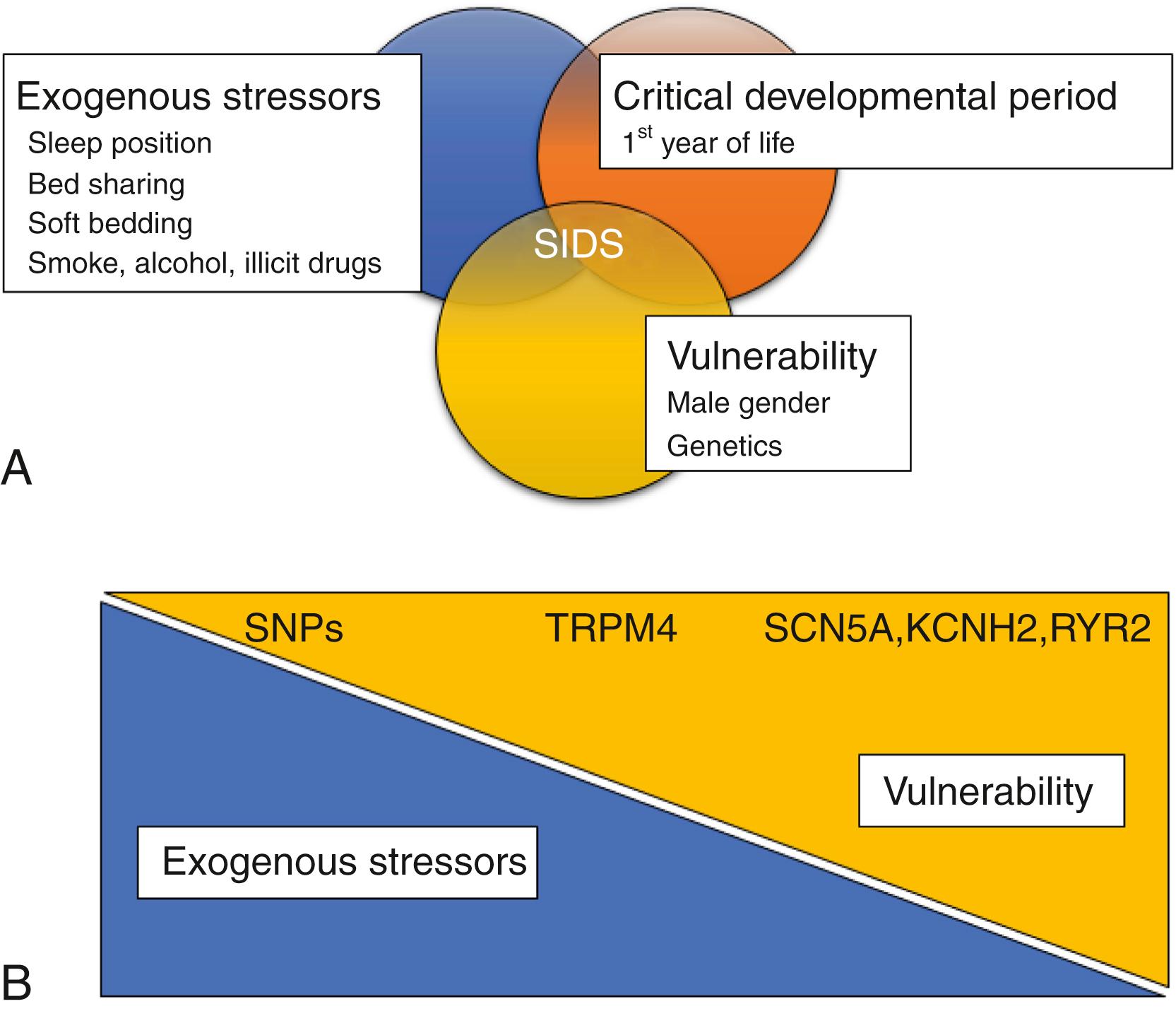 Fig. 13.1, (A) The triple-risk model for the sudden infant death syndrome (SIDS) involves the intersection of three risks, namely a critical developmental period in homeostatic control, the presence of exogenous stressors, and a vulnerable infant. This same model can be applied to sudden death in older children and adults, with the exception that the critical developmental period is less likely to play a role. (B) Thus a dual-risk model with the remaining two factors involves exogenous stressors and a vulnerable individual. Genetic factors contribute to the vulnerability severity, and the genetic penetrance is likely to depend on the acuteness of any known and unknown exogenous stressors.