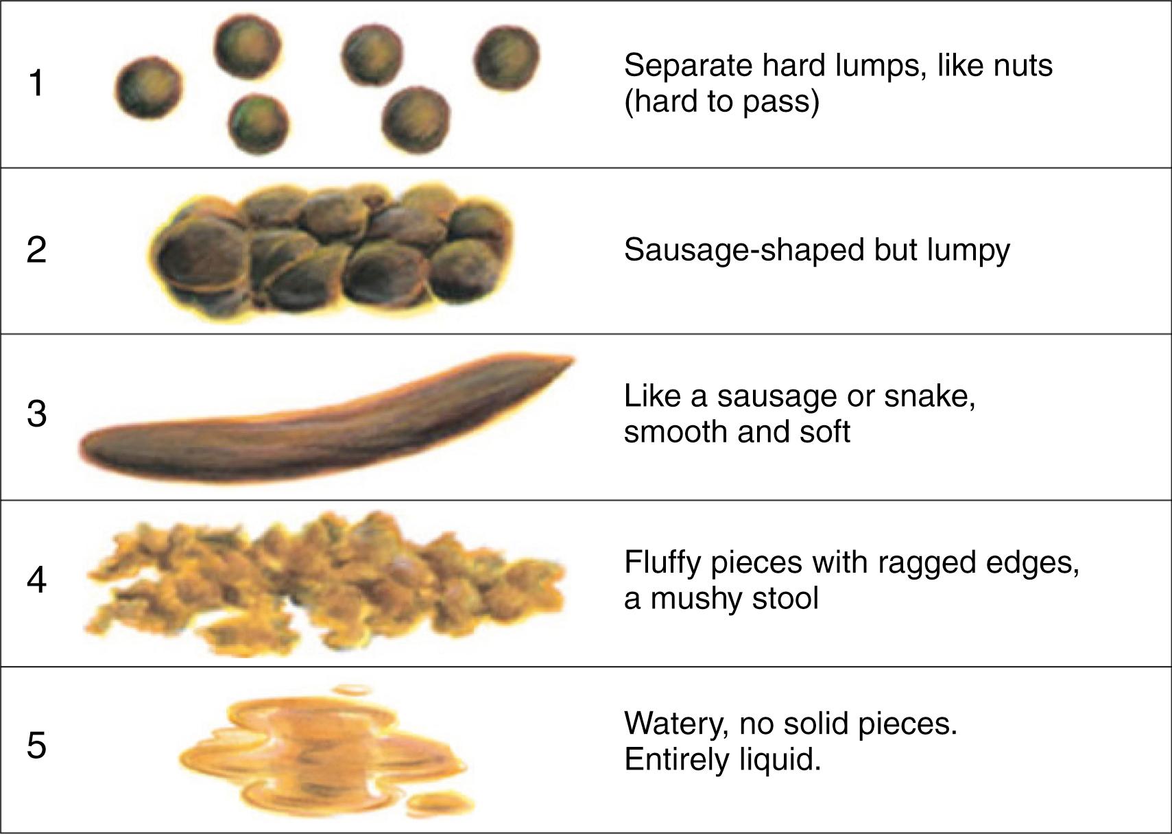 Fig 11.2, Modified Bristol Stool Form Scale for Children.