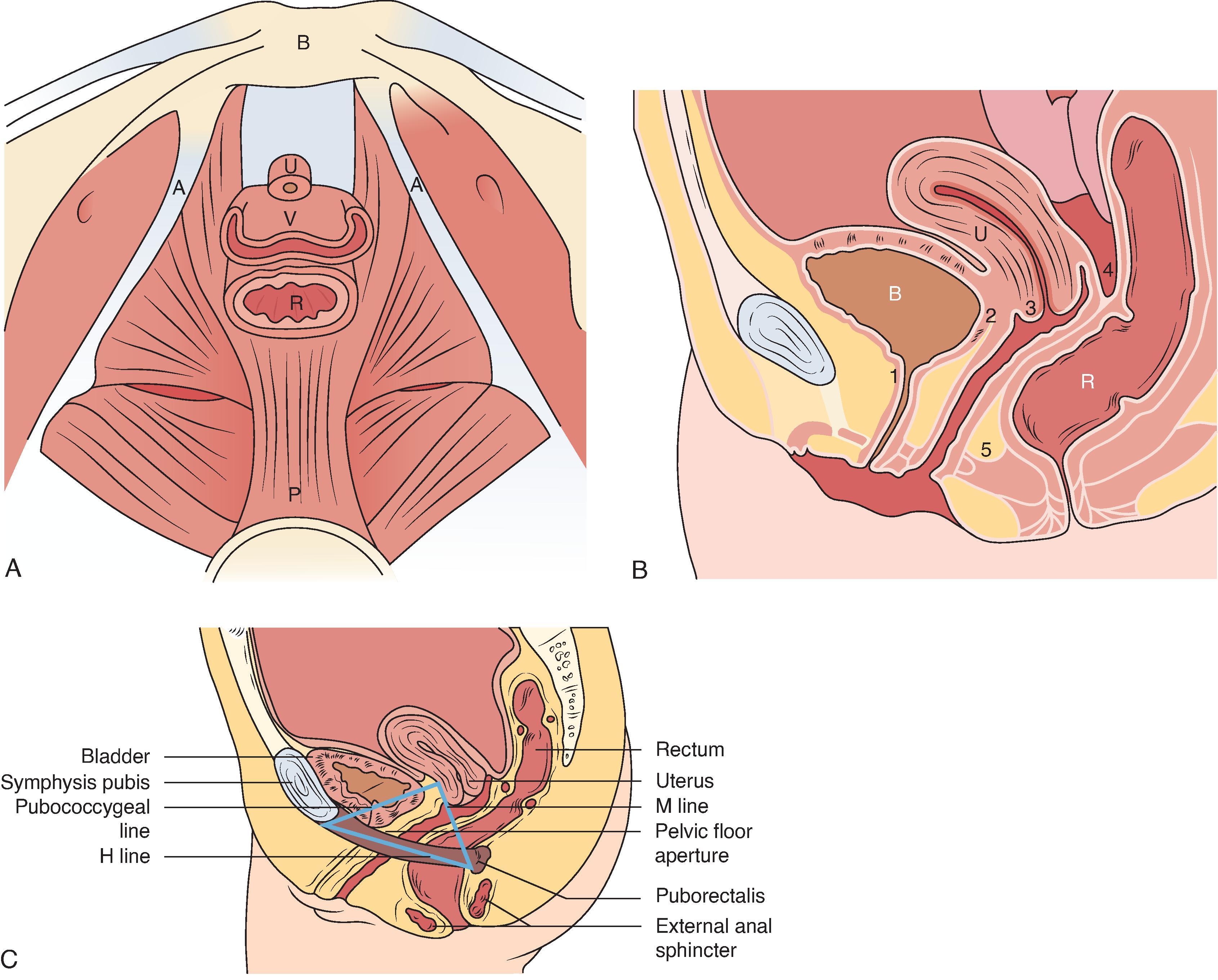 Fig. 37.1, Schematic depiction of normal pelvic anatomy.