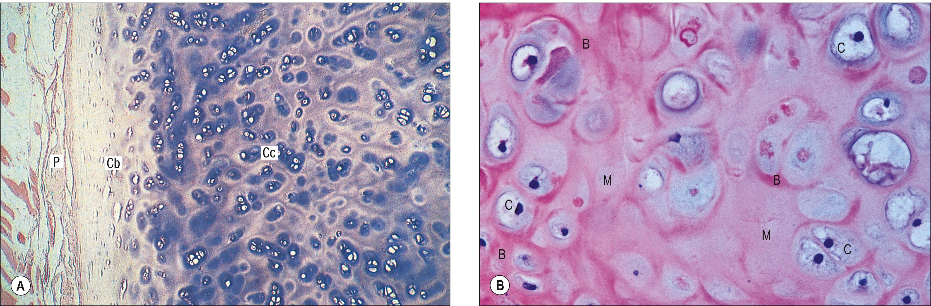 Fig. 5.2, Sections through hyaline cartilage. A , A low-power view of human rib, showing perichondrium (P), young chondroblasts (Cb) embedded in pale-staining interterritorial matrix, and mature chondrocytes (Cc) embedded in the basophilic interterritorial matrix (centre and right). B , Higher magnification of hyaline cartilage in human bronchial wall, showing isogenous groups of chondrocytes (C). Note the more deeply stained basophilic zones (B) (rich in acidic proteoglycans) around the cell clusters, with older, paler-staining matrix (M) between clusters.
