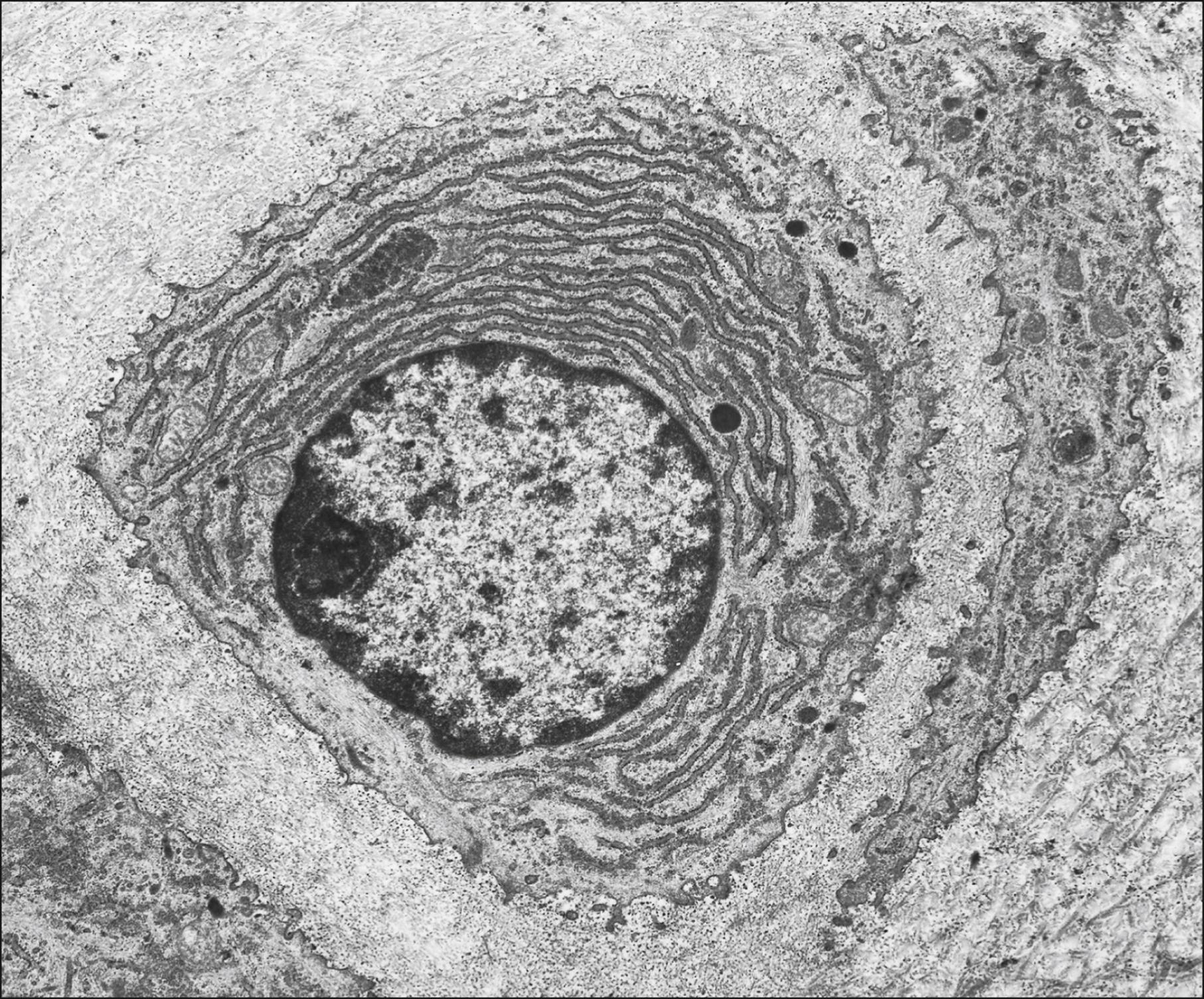 Fig. 5.3, An electron micrograph of chondroblasts in rabbit femoral condylar cartilage. The central cell has an active euchromatic nucleus with a prominent nucleolus, and its cytoplasm contains concentric cisternae of rough endoplasmic reticulum, scattered mitochondria, lysosomes and glycogen aggregates. The plasma membrane bears numerous short filopodia which project into the surrounding matrix. The latter shows a delicate feltwork of collagen fibrils within finely granular interfibrillary material. No pericellular lacuna is present; the matrix separates the central chondroblast from the cytoplasm of two adjacent chondroblasts (left, and crescentic profile).