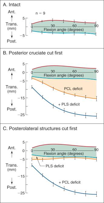 FIG 15-1, Limits of anterior (ant.) and posterior (post.) translation (vertical axis) when a 100-N anteroposterior (AP) force is applied. A, Intact knees. The curves show the average limits of motion and the standard deviation for nine knees. The range of total AP translation of the intact knee is shaded green. B, The posterior cruciate ligament (PCL) is cut first. The increase in posterior translation after cutting the PCL is shown in the area shaded in orange (PCL deficit). The limit of posterior translation, and therefore the amount of increase, is controlled by the remaining intact structures. The unshaded portion (+ posterolateral structure [PLS] deficit) shows the added increase when the PLSs (fibular collateral ligament, capsule, popliteus muscle-tendon-ligament) were cut after the PCL had first been removed. A concurrent external rotation took place with this cut. C, The PLSs are cut first. There was only a small increase (PLS deficit) in the posterior limit near full extension when the posterolateral structural elements were cut first. A concurrent external rotation was also present.