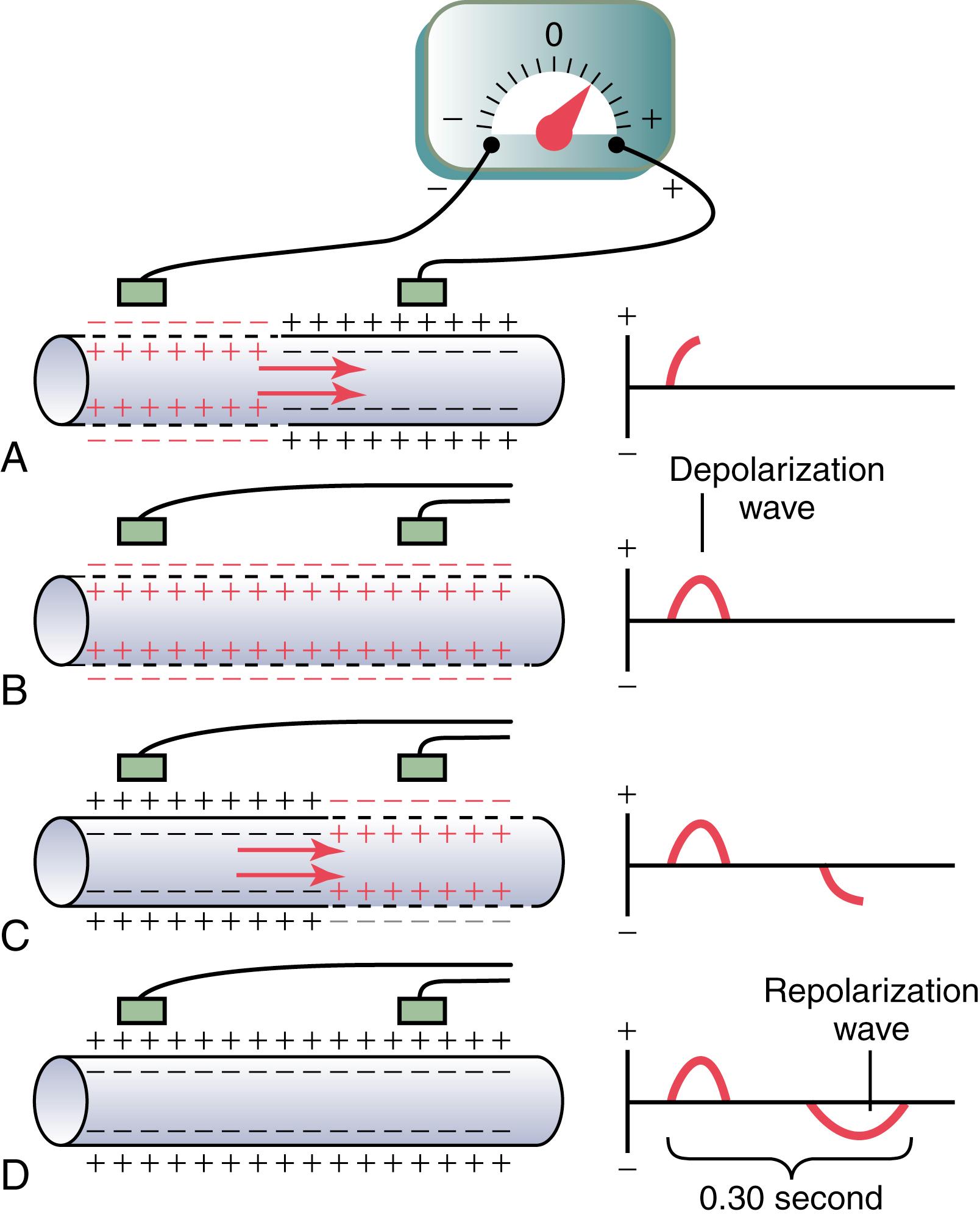 Figure 11-2., Recording the depolarization wave ( A and B ) and the repolarization wave ( C and D ) from a cardiac muscle fiber.