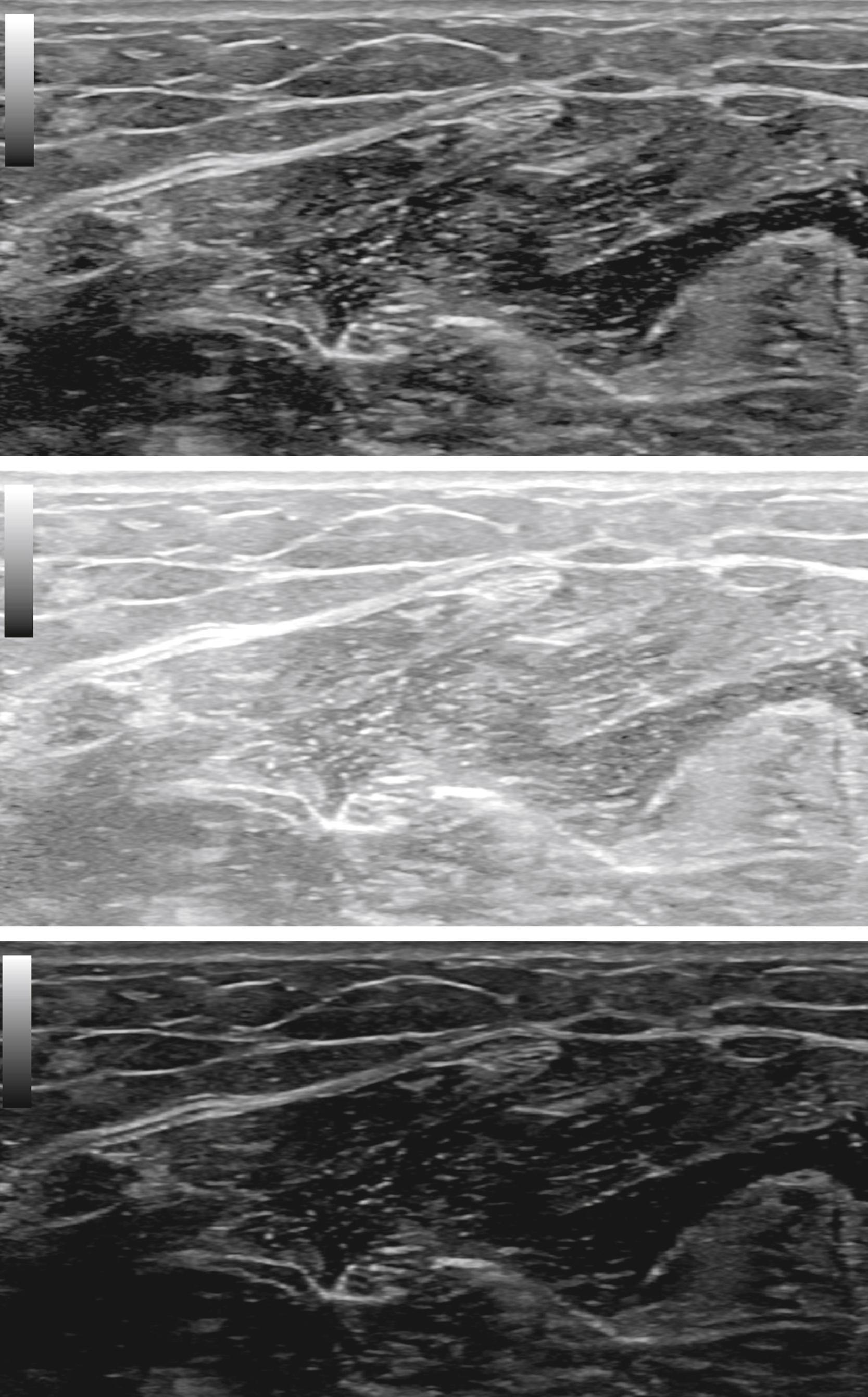 Fig. 17.11, Brightness adjustment.