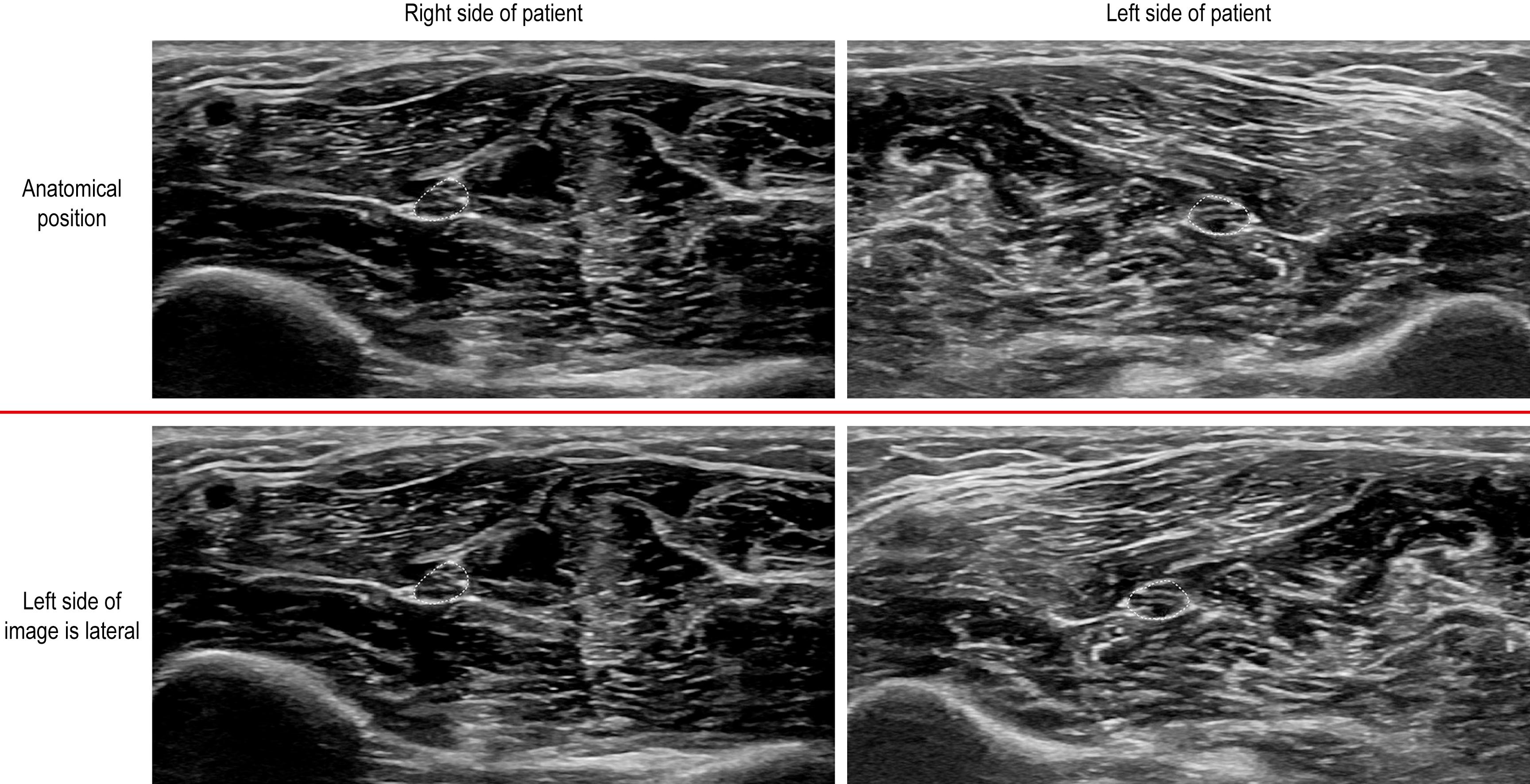 Fig. 17.14, Conventions for axial scans.