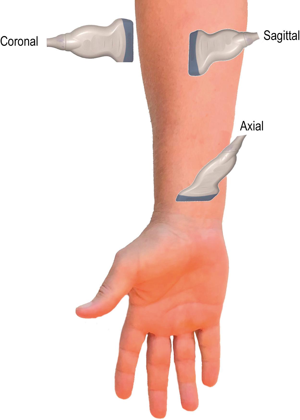 Fig. 17.15, Imaging planes.