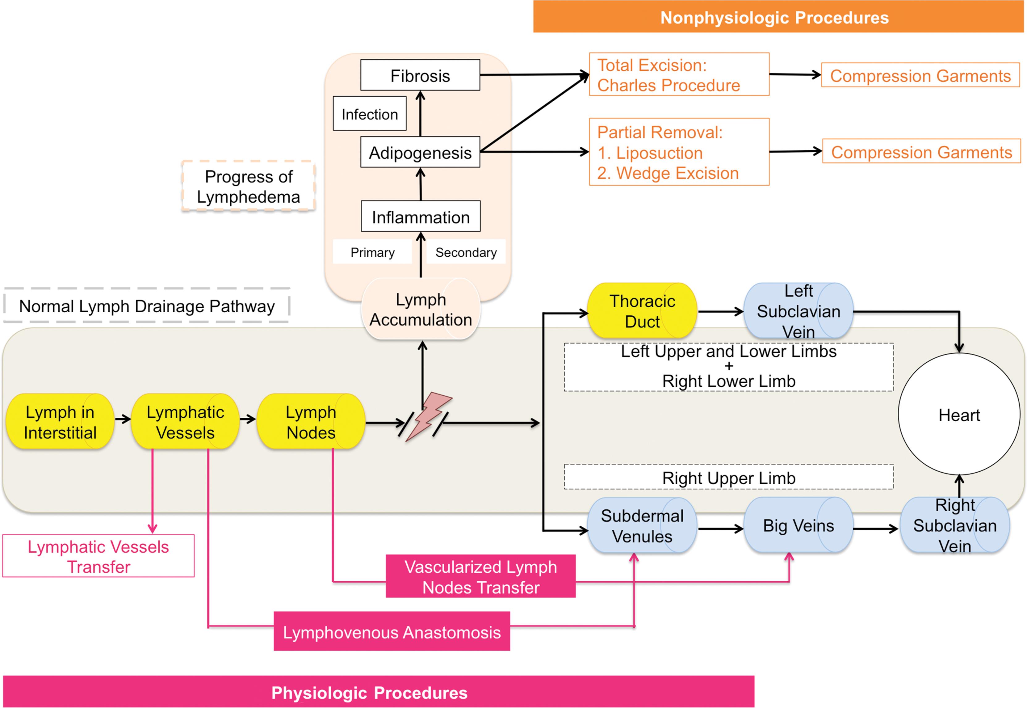 Fig. 27.2, The flow diagram represents the impact of both physiologic and nonphysiologic methods of surgical treatment on the lymphatic system.