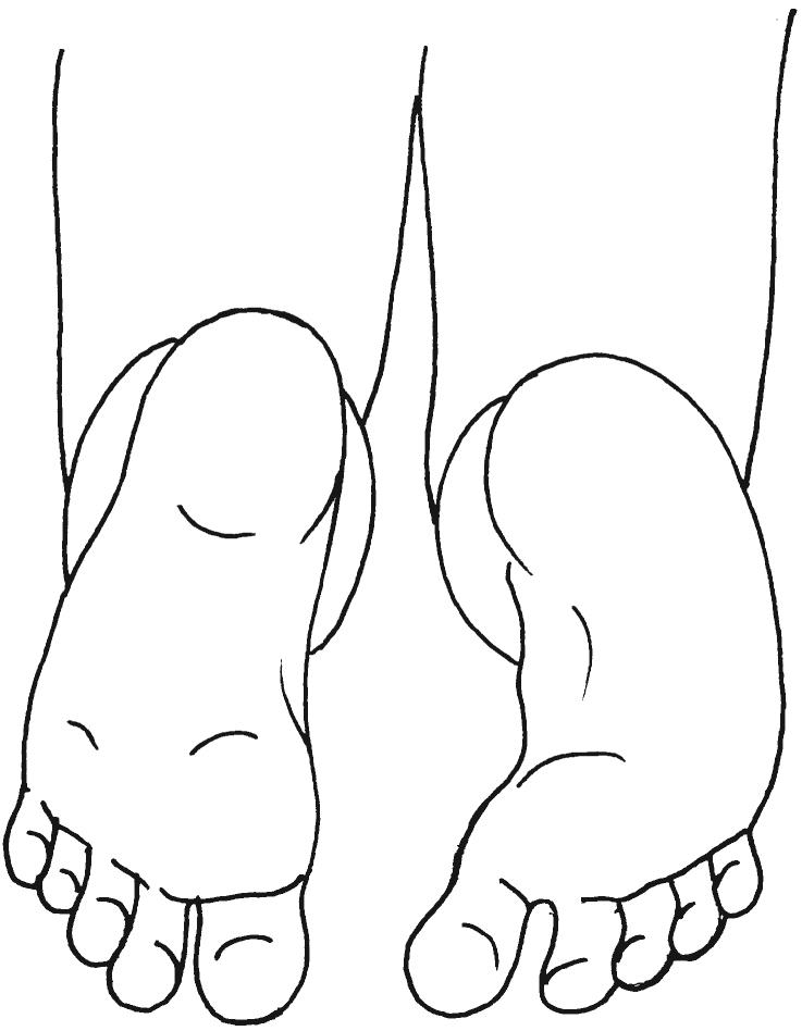 Fig. 45.9, Foot shape. In the same position as for measurement of the thigh-foot angle, the shape of the foot can also be evaluated. In this illustration, the left foot has normal alignment and the right foot demonstrates metatarsus adductus.