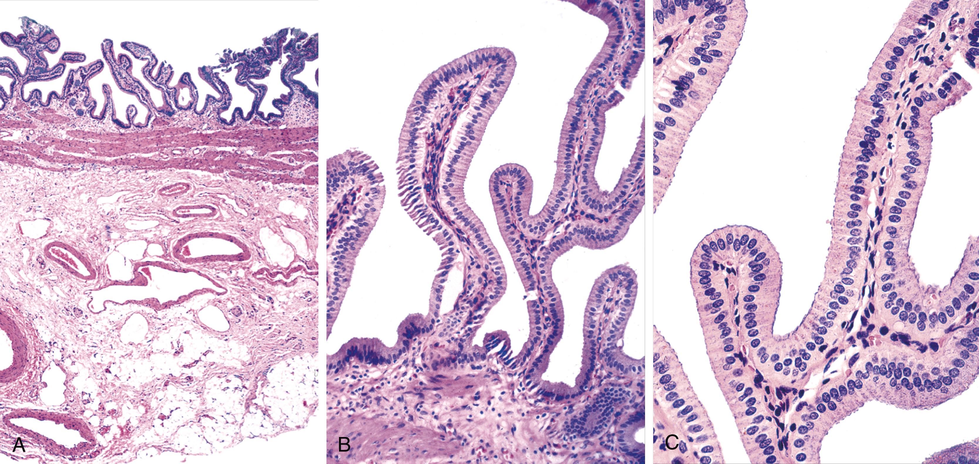 FIGURE 34.1, Histology of the normal gallbladder.