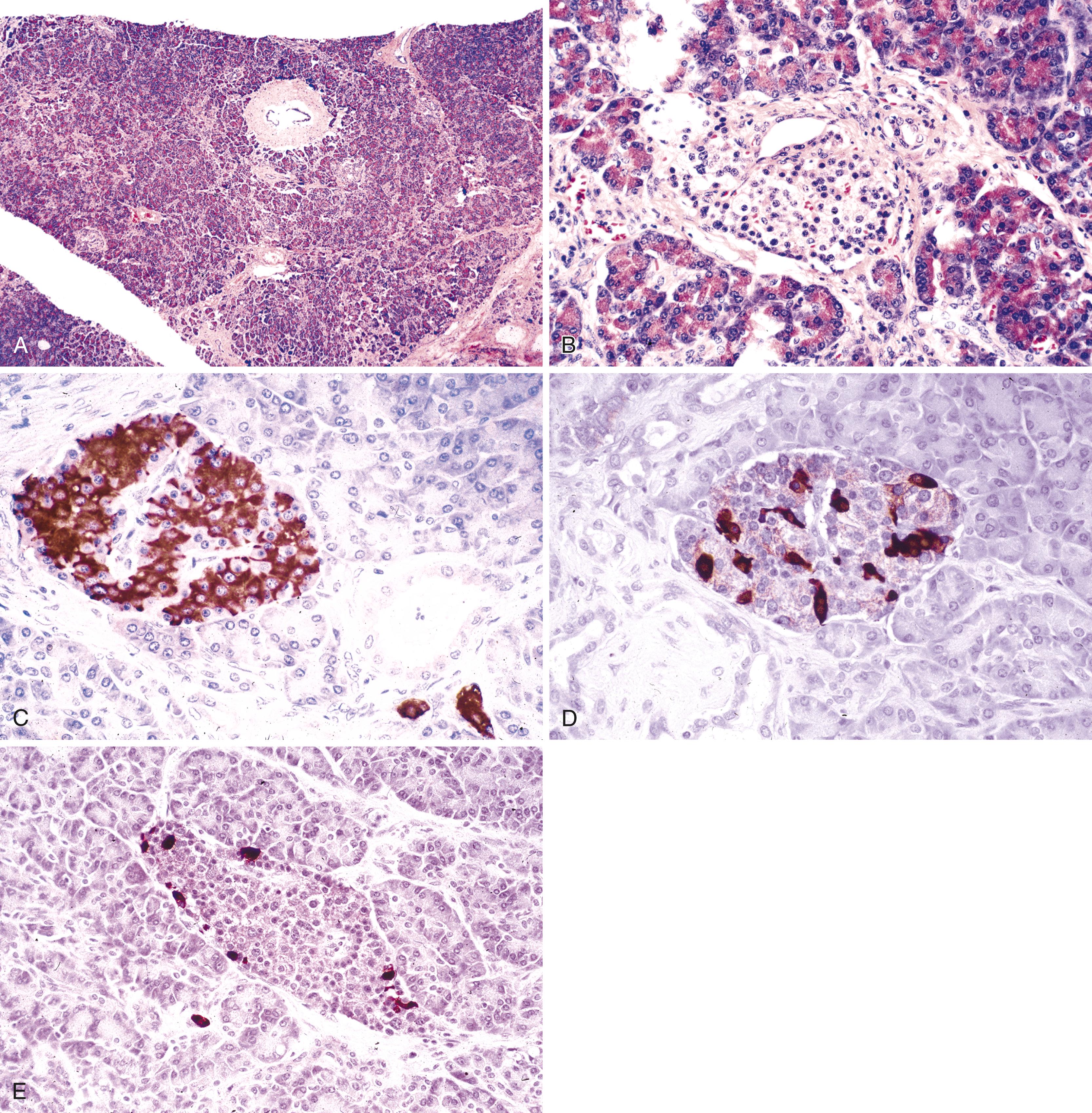 FIGURE 34.2, Histology of the normal pancreas.