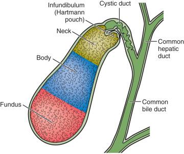 Figure 21.1, The gallbladder is divided into the fundus, body, and neck; the portion of the body adjoining the neck is referred to as the infundibulum. A small bulge in this portion is known as Hartmann pouch, notable because gallstones may become lodged here.