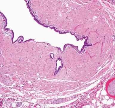 Figure 21.6, The epithelium within all the extrahepatic bile ducts is made up of a single layer of columnar cells resting on dense connective tissue.