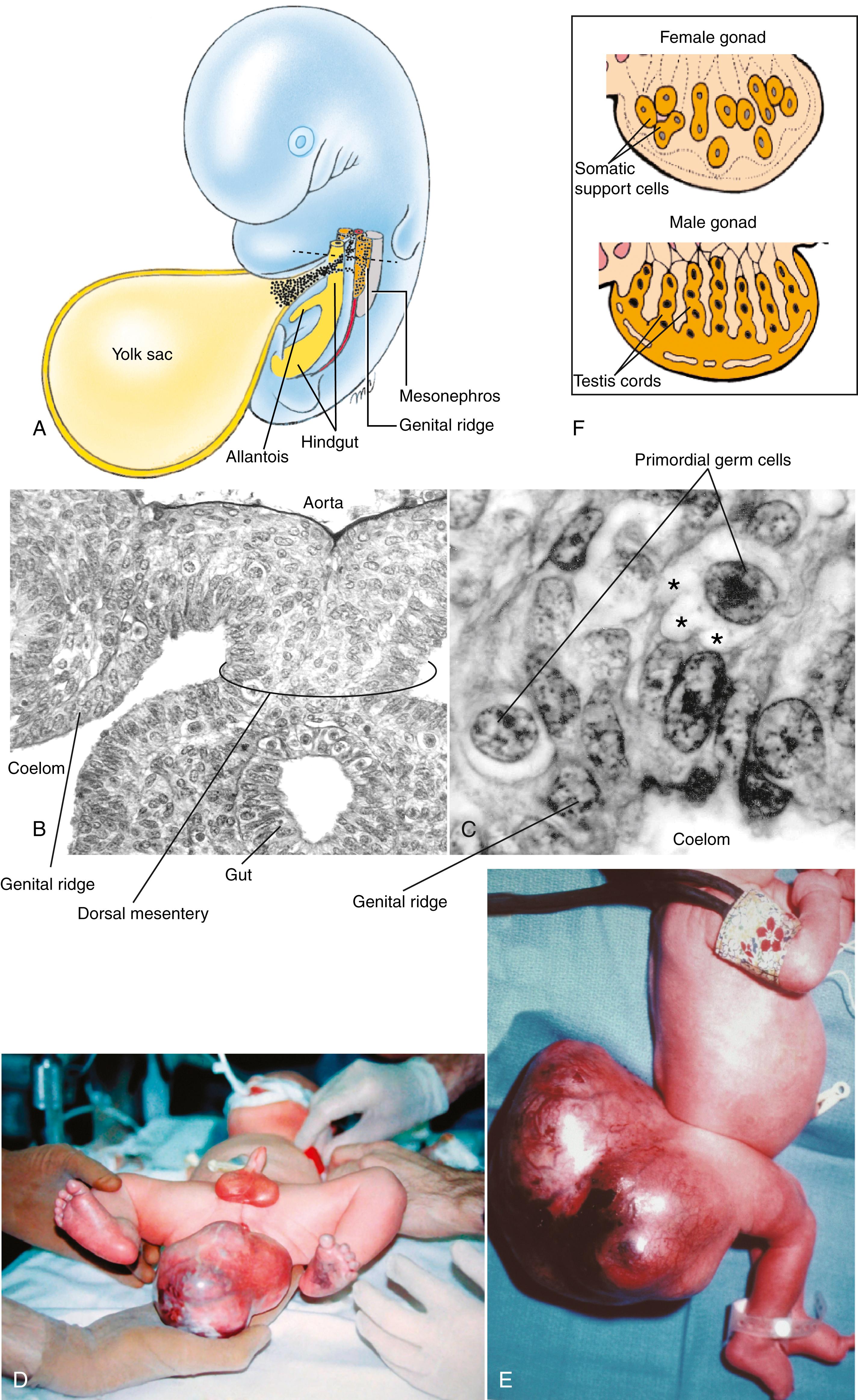 Fig. 1.1, Yolk-Sac Origin of Primordial Germ Cells and Their Migration During Normal Development, and Formation of Teratomas