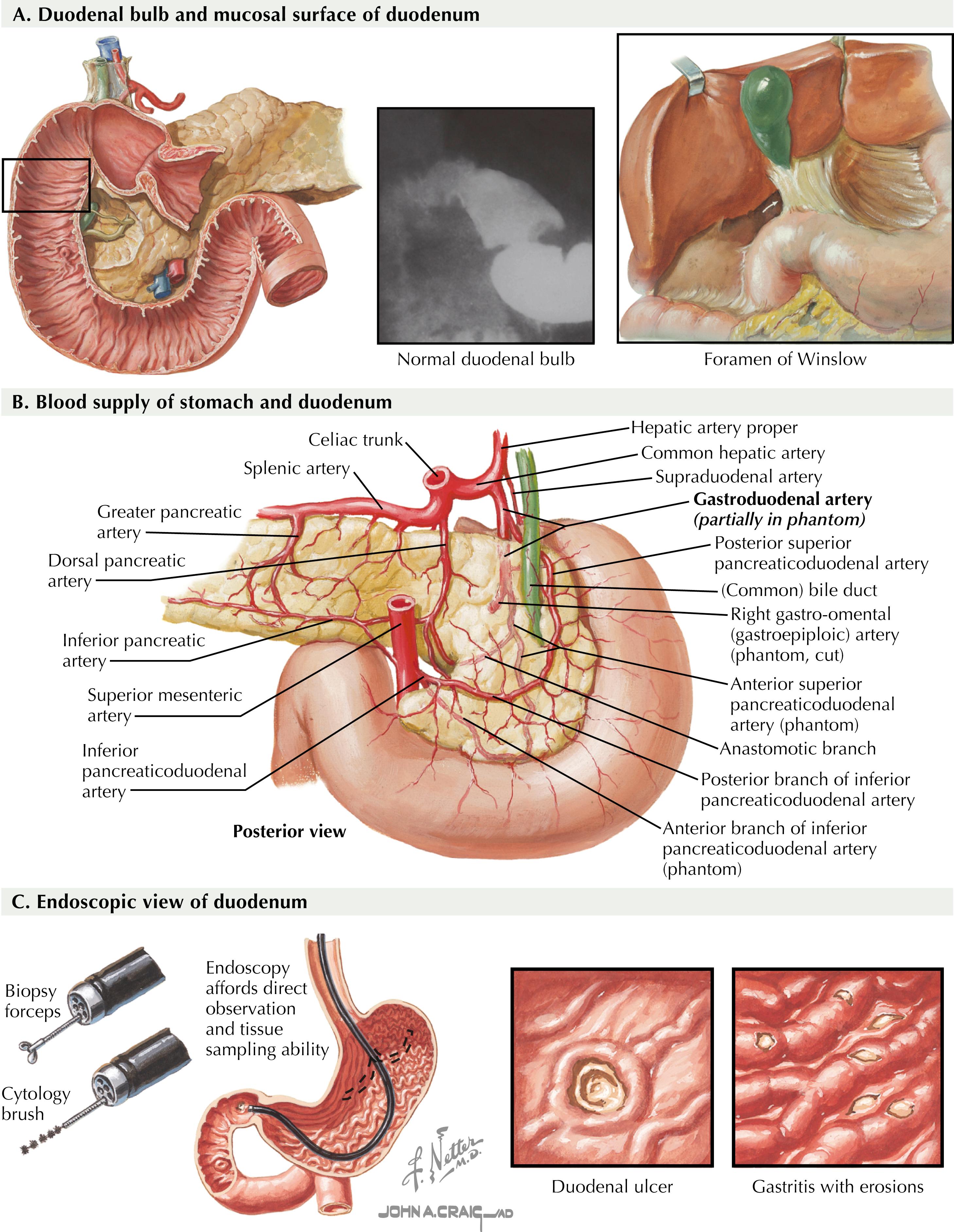 FIGURE 9.1, Duodenal bulb, blood supply, and endoscopic view.