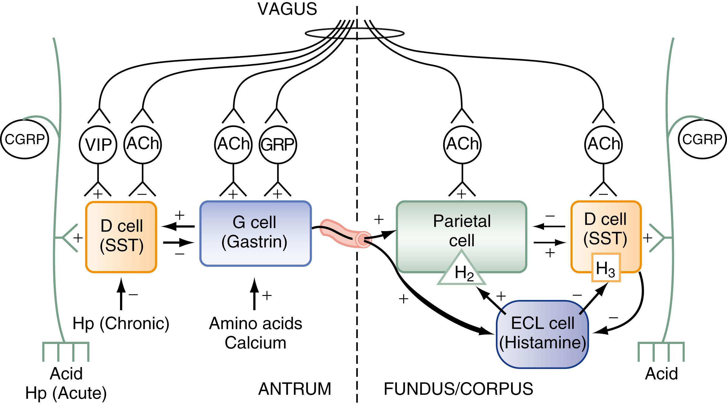 Fig. 51.10, Model illustrating the neural, hormonal, and paracrine regulation of gastric acid secretion in health and disease. Efferent vagal fibers synapse with intramural enteric cholinergic (ACh) and peptidergic ( GRP and VIP ) neurons. In the fundus (oxyntic mucosa), ACh neurons stimulate acid secretion directly as well as indirectly by inhibiting somatostatin (SST) secretion, thus eliminating its restraint on parietal cells and histamine-containing ECL cells. In the antrum (pyloric mucosa), ACh neurons stimulate gastrin secretion directly as well as indirectly by inhibiting SST secretion, thus eliminating its restraint on gastrin-containing G cells. GRP neurons, activated by luminal protein, also stimulate gastrin secretion. Amino acids and calcium may directly stimulate gastrin secretion. VIP neurons, activated by low-grade gastric distention, stimulate SST and thus inhibit gastrin secretion. Dual paracrine pathways link SST-containing D cells to parietal cells and to ECL cells in the fundus. Histamine released from ECL cells acts via H 3 receptors to inhibit SST secretion. This serves to accentuate the decrease in SST secretion induced by cholinergic stimuli and thus augments acid secretion. In the antrum, dual paracrine pathways link SST-containing D cells to gastrin cells. Release of acid into the lumen of the stomach activates extrinsic CGRP sensory neurons that act to restore SST secretion in both the fundus and antrum. Acute infection with Hp also activates CGRP neurons to stimulate SST and thus inhibit gastrin (and acid) secretion; inhibition of acid facilitates colonization and infection. In patients with duodenal ulcer who are chronically infected with Hp, the organism or cytokines released from the inflammatory infiltrate inhibit SST and thus stimulate gastrin (and acid) secretion. +, stimulation; −, inhibition.