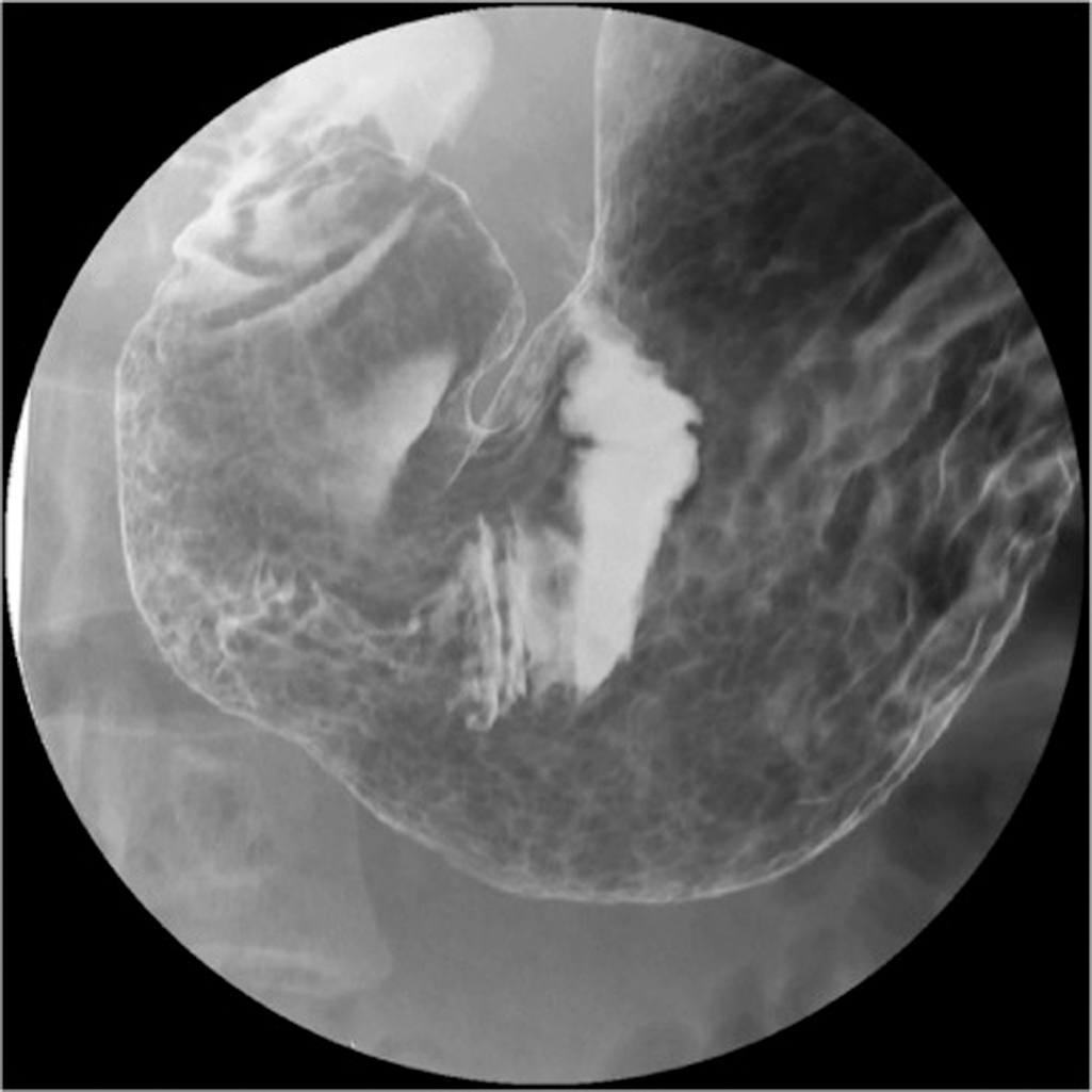 Fig. 3.1, Areae gastricae representing a normal mucosal pattern.