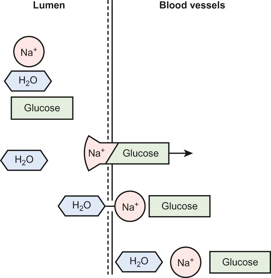 Fig. 14.6, Mechanism of action of sodium-glucose cotransport in facilitating enhanced absorption of fluid from the gut with oral rehydration solution.