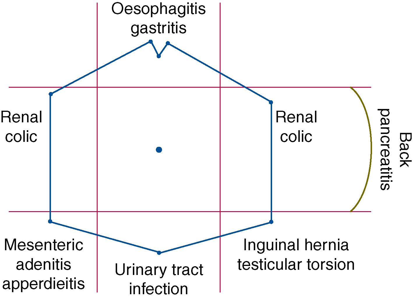 Fig. 19.1, Location of acute abdominal pain and underlying pathology