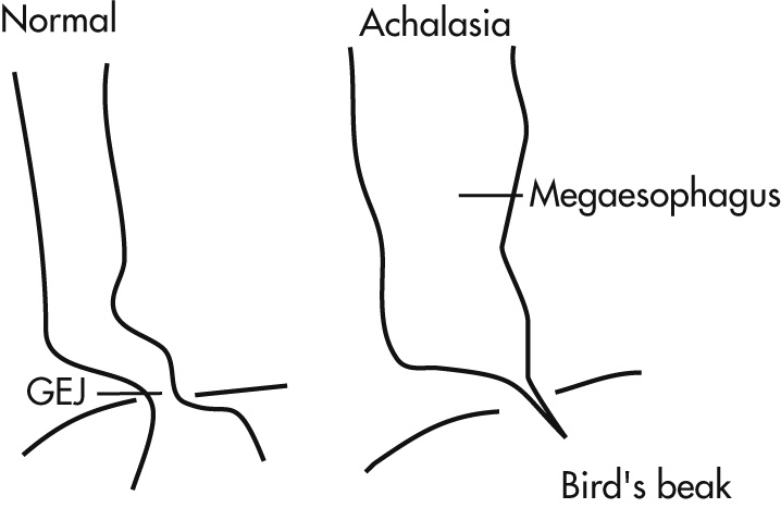 FIG. 3.11