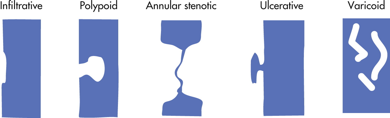 FIG. 3.14