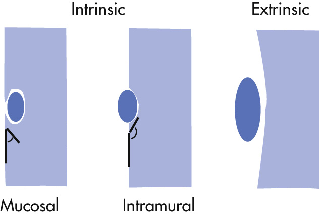 FIG. 3.17