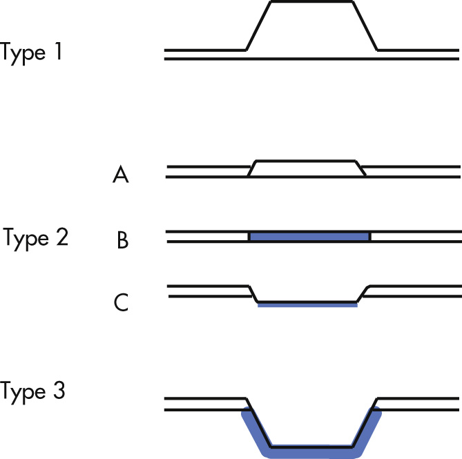 FIG. 3.20