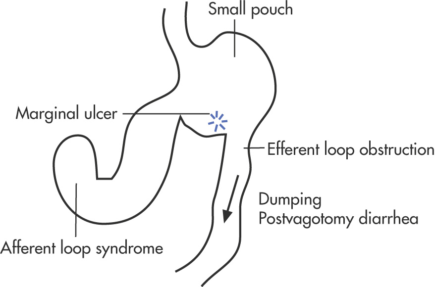 FIG. 3.25