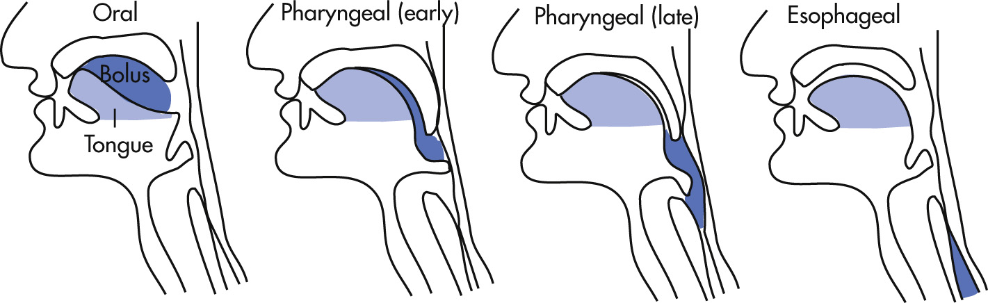 FIG. 3.3