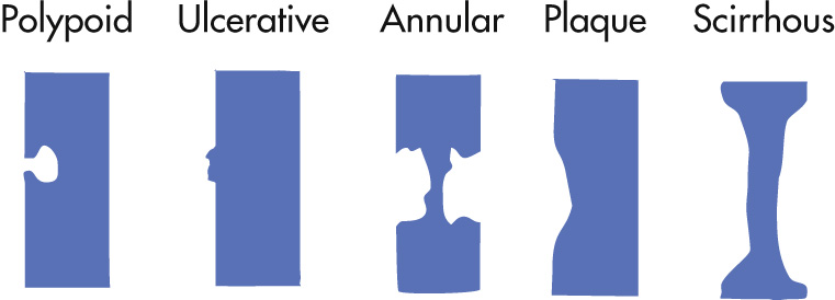 FIG. 3.32