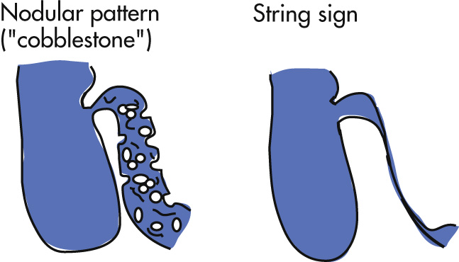 FIG. 3.35