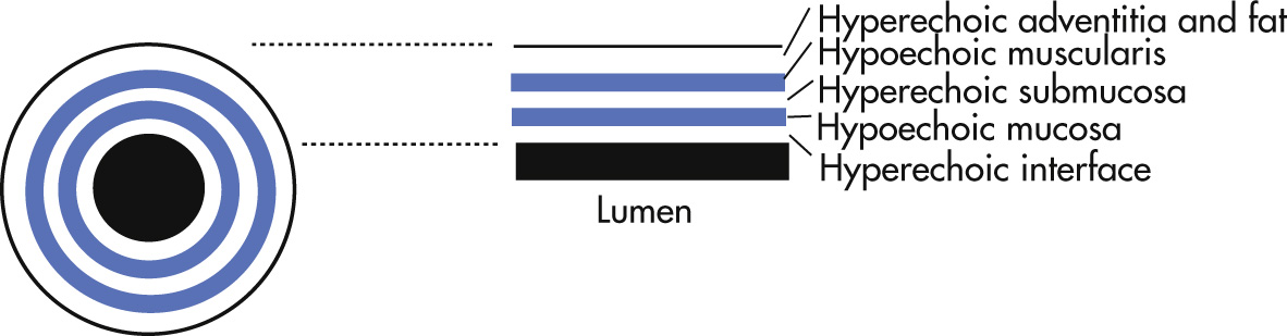 FIG. 3.4