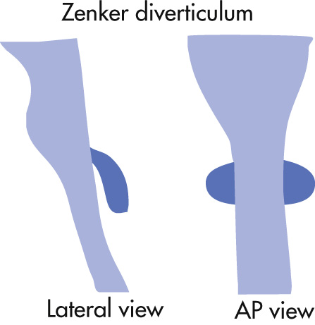 FIG. 3.6