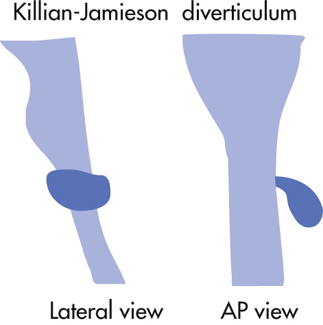 FIG. 3.7